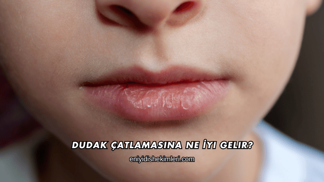 Dudak Çatlamasına Ne İyi Gelir?