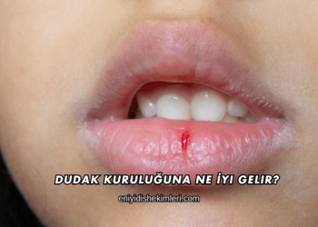 Dudak Kuruluğuna Ne İyi Gelir?