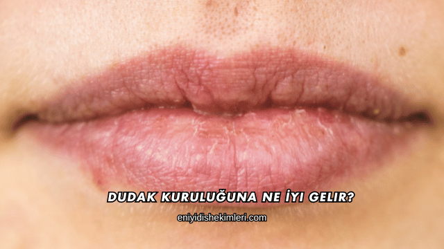 Dudak Kuruluğuna Ne İyi Gelir?