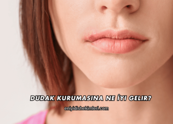 Dudak Kurumasına Ne İyi Gelir?