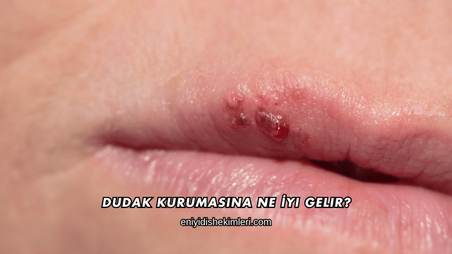 Dudak Kurumasına Ne İyi Gelir?