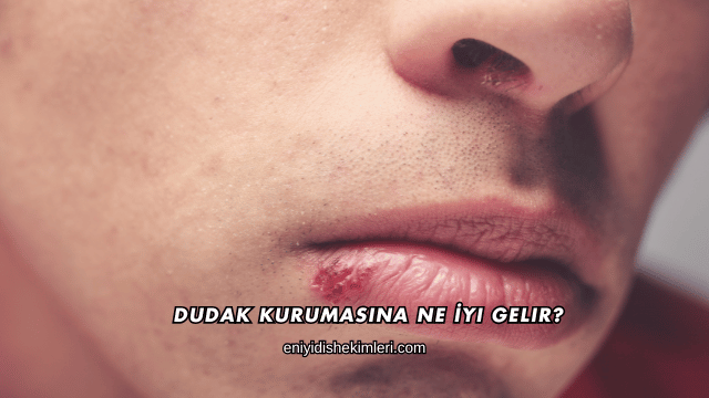 Dudak Kurumasına Ne İyi Gelir?