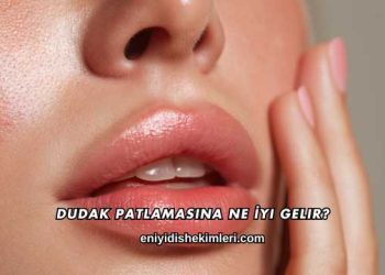 Dudak Patlamasına Ne İyi Gelir?