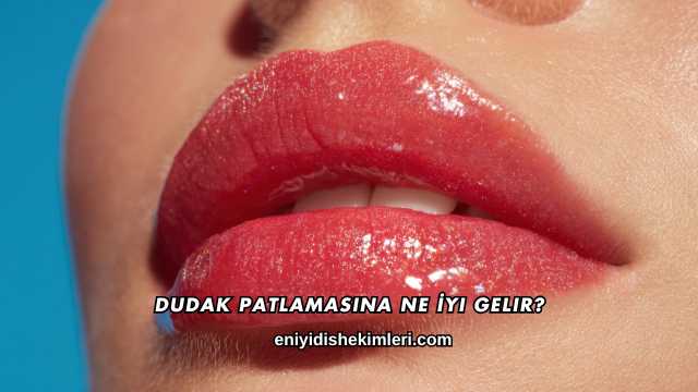 Dudak Patlamasına Ne İyi Gelir?