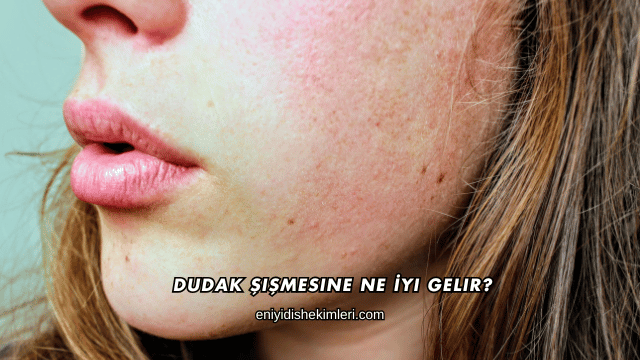 Dudak Şişmesine Ne İyi Gelir?