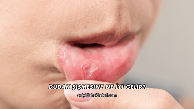 Dudak Şişmesine Ne İyi Gelir?