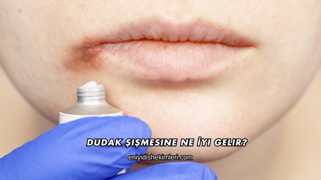Dudak Şişmesine Ne İyi Gelir?