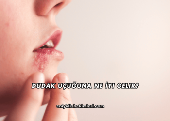 Dudak Uçuğuna Ne İyi Gelir?
