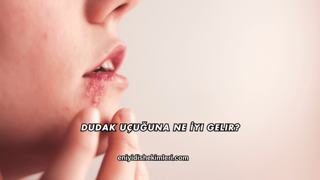 Dudak Uçuğuna Ne İyi Gelir?