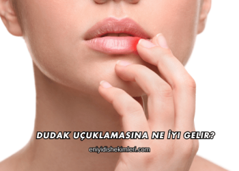 Dudak Uçuklamasına Ne İyi Gelir?