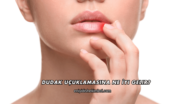 Dudak Uçuklamasına Ne İyi Gelir?
