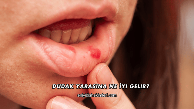 Dudak Yarasına Ne İyi Gelir?