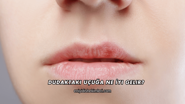 Dudaktaki Uçuğa Ne İyi Gelir?
