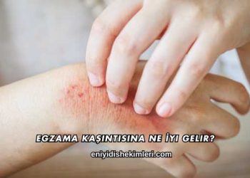 Egzama Kaşıntısına Ne İyi Gelir?
