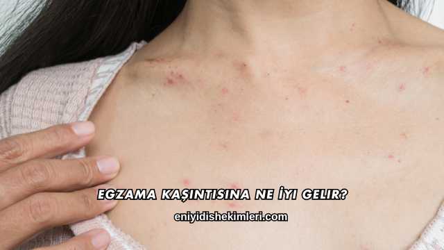 Egzama Kaşıntısına Ne İyi Gelir?