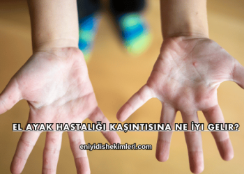 El Ayak Hastalığı Kaşıntısına Ne İyi Gelir?