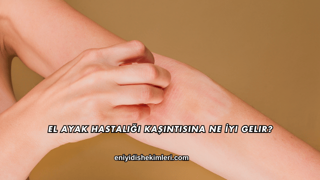 El Ayak Hastalığı Kaşıntısına Ne İyi Gelir?