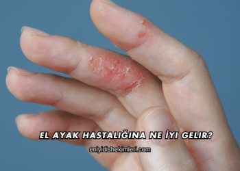 El Ayak Hastalığına Ne İyi Gelir?