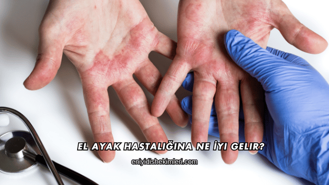 El Ayak Hastalığına Ne İyi Gelir?