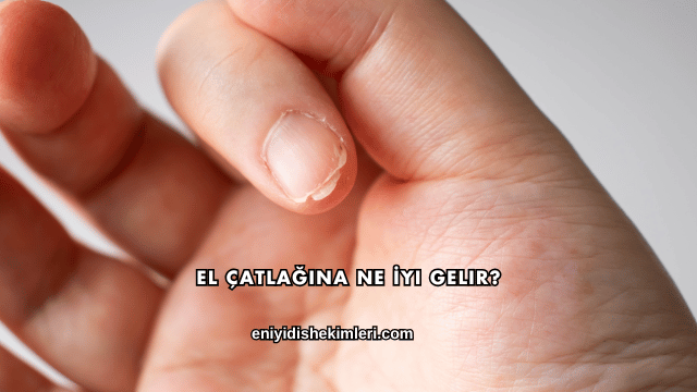 El Çatlağına Ne İyi Gelir?