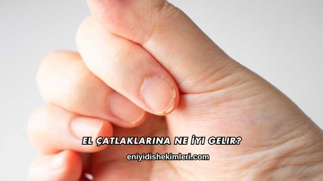 El Çatlaklarına Ne İyi Gelir?