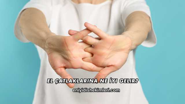 El Çatlaklarına Ne İyi Gelir?