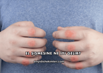 El Şişmesine Ne İyi Gelir?