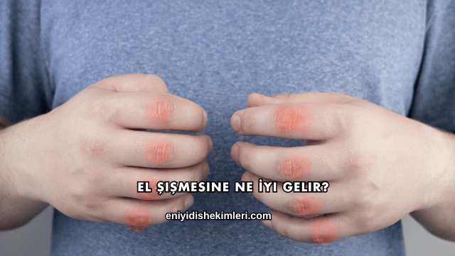 El Şişmesine Ne İyi Gelir?