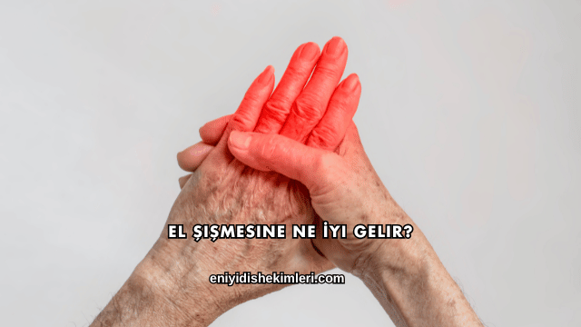 El Şişmesine Ne İyi Gelir?