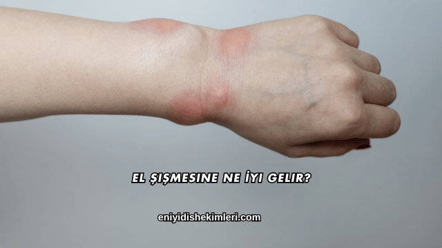 El Şişmesine Ne İyi Gelir?