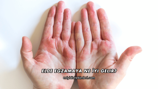Elde Egzamaya Ne İyi Gelir?