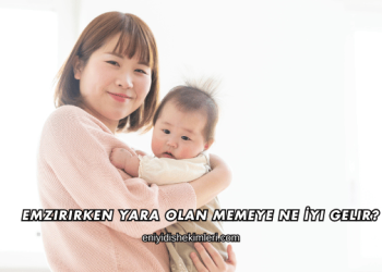 Emzirirken Yara Olan Memeye Ne İyi Gelir?