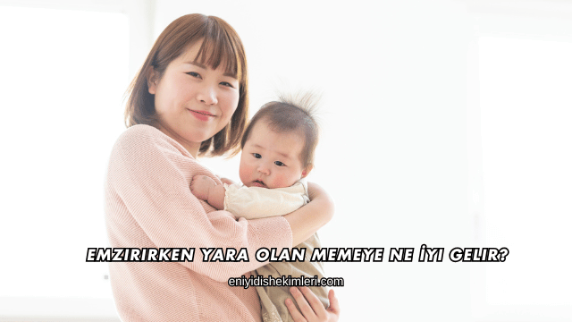 Emzirirken Yara Olan Memeye Ne İyi Gelir?