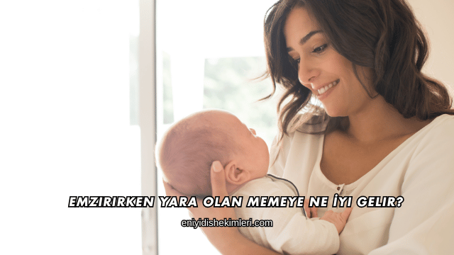 Emzirirken Yara Olan Memeye Ne İyi Gelir?