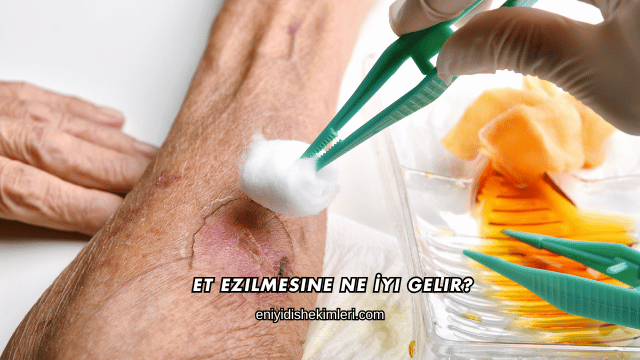 Et Ezilmesine Ne İyi Gelir?