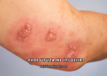 Evde Uyuza Ne İyi Gelir