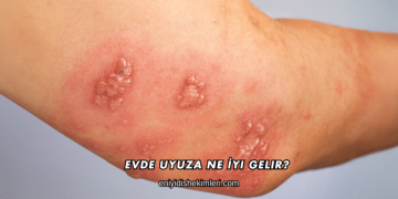 Evde Uyuza Ne İyi Gelir