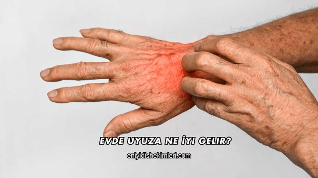 Evde Uyuza Ne İyi Gelir