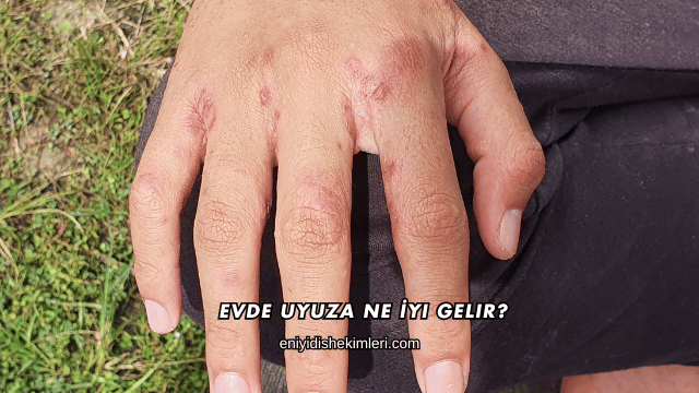 Evde Uyuza Ne İyi Gelir