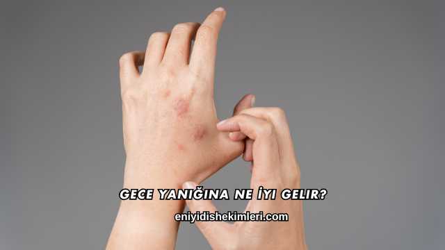 Gece Yanığına Ne İyi Gelir?