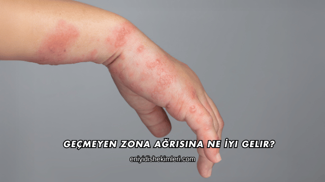 Geçmeyen Zona Ağrısına Ne İyi Gelir?