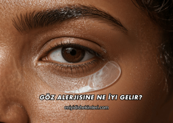 Göz Alerjisine Ne İyi Gelir?