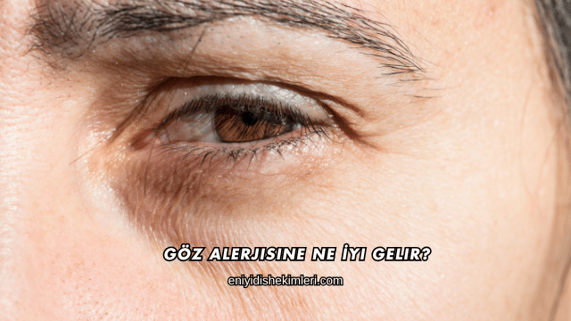 Göz Alerjisine Ne İyi Gelir?