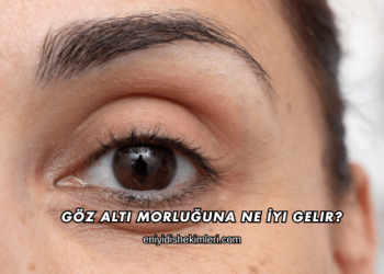 Göz Altı Morluğuna Ne İyi Gelir?