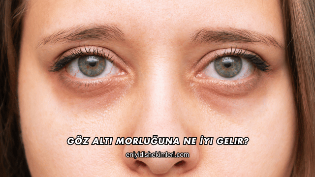 Göz Altı Morluğuna Ne İyi Gelir?