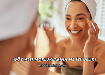 Göz Altı Morluklarına Ne İyi Gelir?