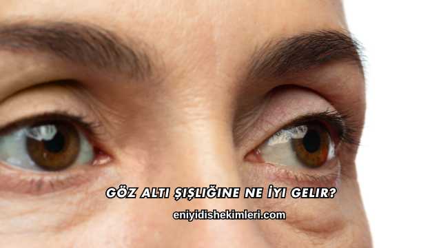 Göz Altı Şişliğine Ne İyi Gelir?