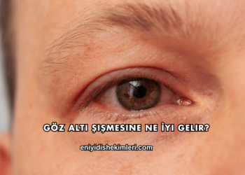 Göz Altı Şişmesine Ne İyi Gelir?