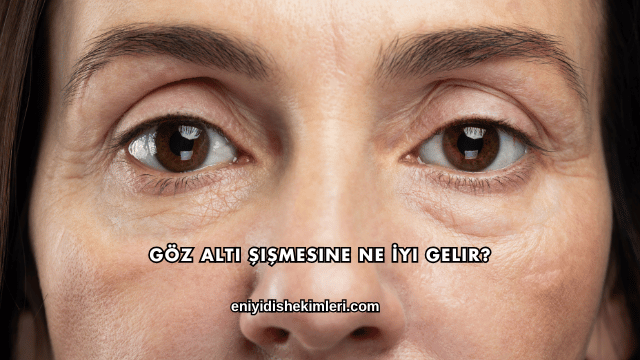 Göz Altı Şişmesine Ne İyi Gelir?