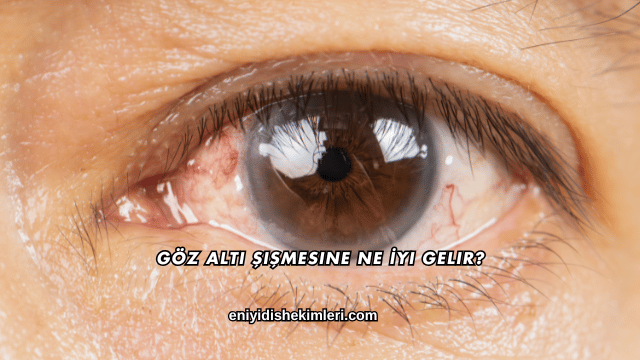 Göz Altı Şişmesine Ne İyi Gelir?